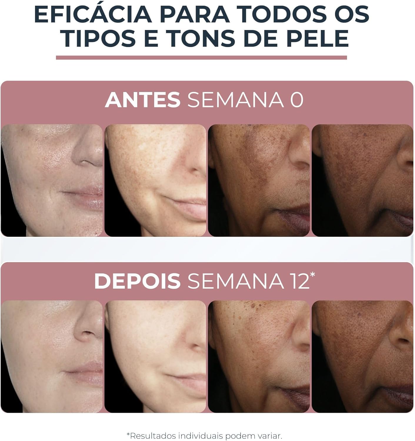 Eucerin Crema facial hidratante noche anti manchas Anti Pigment, 50ml