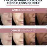 Eucerin Crema facial hidratante noche anti manchas Anti Pigment, 50ml